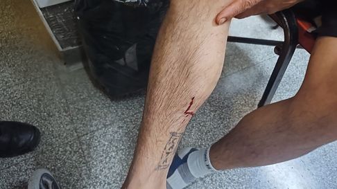 lo balearon para robarle la moto en villa elisa lo balearon para robarle la moto en villa elisa