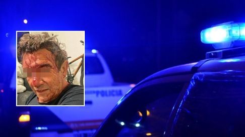 lo golpearon y balearon en una entradera en city bell lo golpearon y balearon en una entradera en city bell