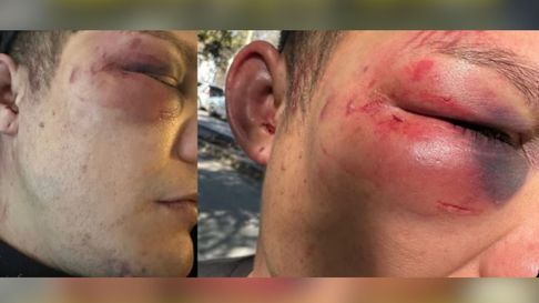 Un joven fue víctima de una terrible golpiza en La Plata Un joven fue víctima de una terrible golpiza en La Plata