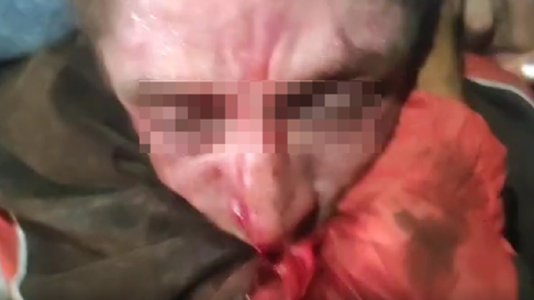 En Altos de San Lorenzo ocurrió un hecho de inseguridad y violencia En Altos de San Lorenzo ocurrió un hecho de inseguridad y violencia