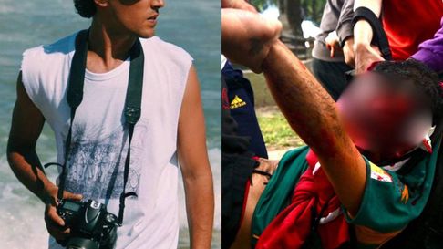 quien es pablo grillo, el fotografo herido durante la represion quien es pablo grillo, el fotografo herido durante la represion