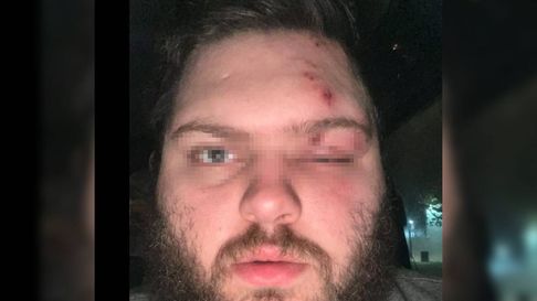 Un herido en barrio Hipódromo en la quema de muñecos de fin de año Un herido en barrio Hipódromo en la quema de muñecos de fin de año