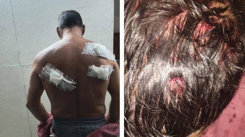 Extrema violencia en Tolosa: quiso matar al novio de su ex Extrema violencia en Tolosa: quiso matar al novio de su ex