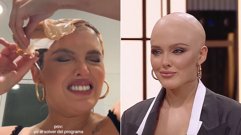 sofia gonet mostro el doloroso proceso al que se sometio al terminar masterchef sofia gonet mostro el doloroso proceso al que se sometio al terminar masterchef