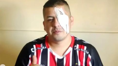 un hombre perdio un ojo durante la represion y denuncio a patricia bullrich un hombre perdio un ojo durante la represion y denuncio a patricia bullrich