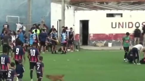 jugador de la liga amateur platense choco accidentalmente a una fotografa jugador de la liga amateur platense choco accidentalmente a una fotografa