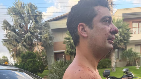 Uno de los futbolistas involucrados en una trifulca vecinal en Brasil. Uno de los futbolistas involucrados en una trifulca vecinal en Brasil.