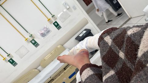 El joven herido sufrió quebraduras en sus dos pies. El joven herido sufrió quebraduras en sus dos pies.